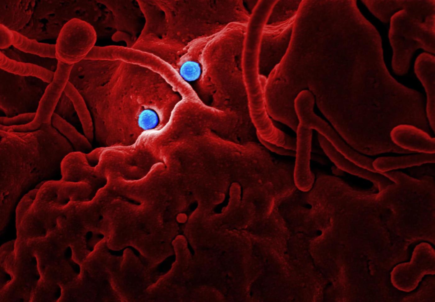 Why Your Immune System Is the Most Sophisticated Thing in the Known Universe