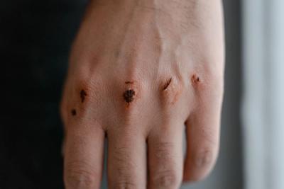 The Real Reason Paper Cuts Hurt More Than Wounds That Are Twice as Deep