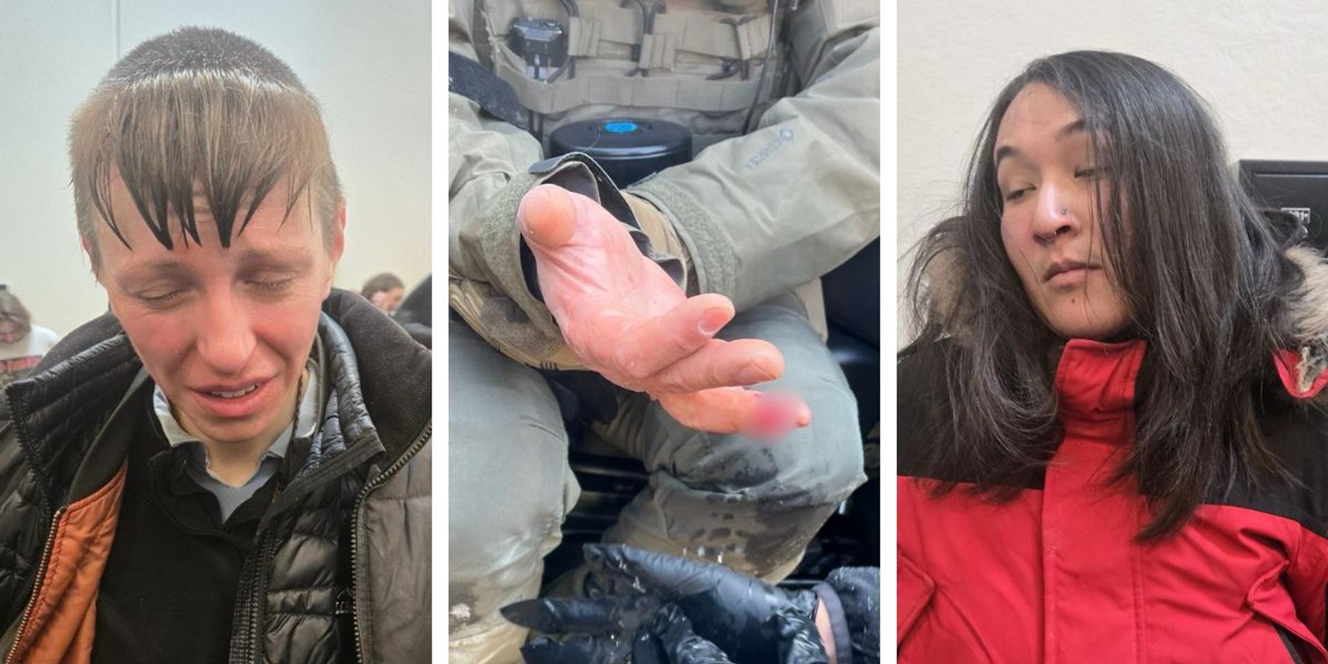 BREAKING: Minneapolis anti-ICE rioters attacked federal officer, and one bit his finger off: DHS