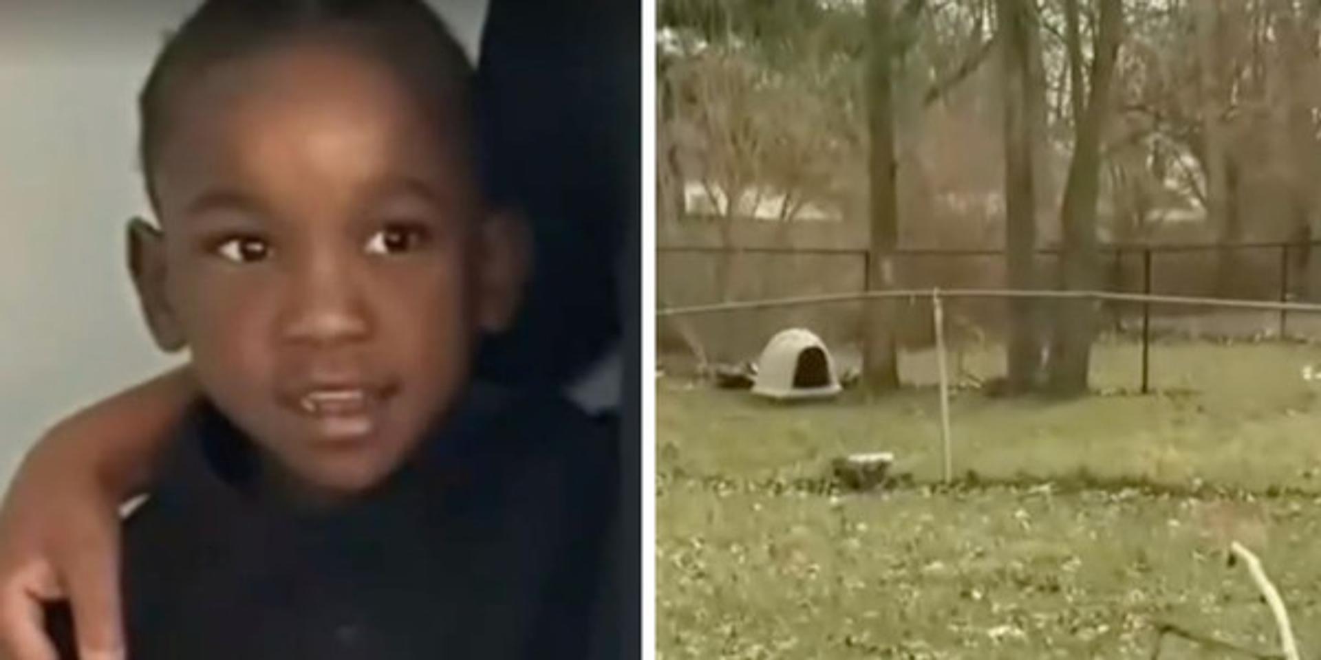 6-year-old Detroit boy loses arm, may see the other amputated, after being mauled by father's dogs