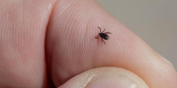 First American dies from tick-borne alpha gal meat allergy hours after eating hamburger