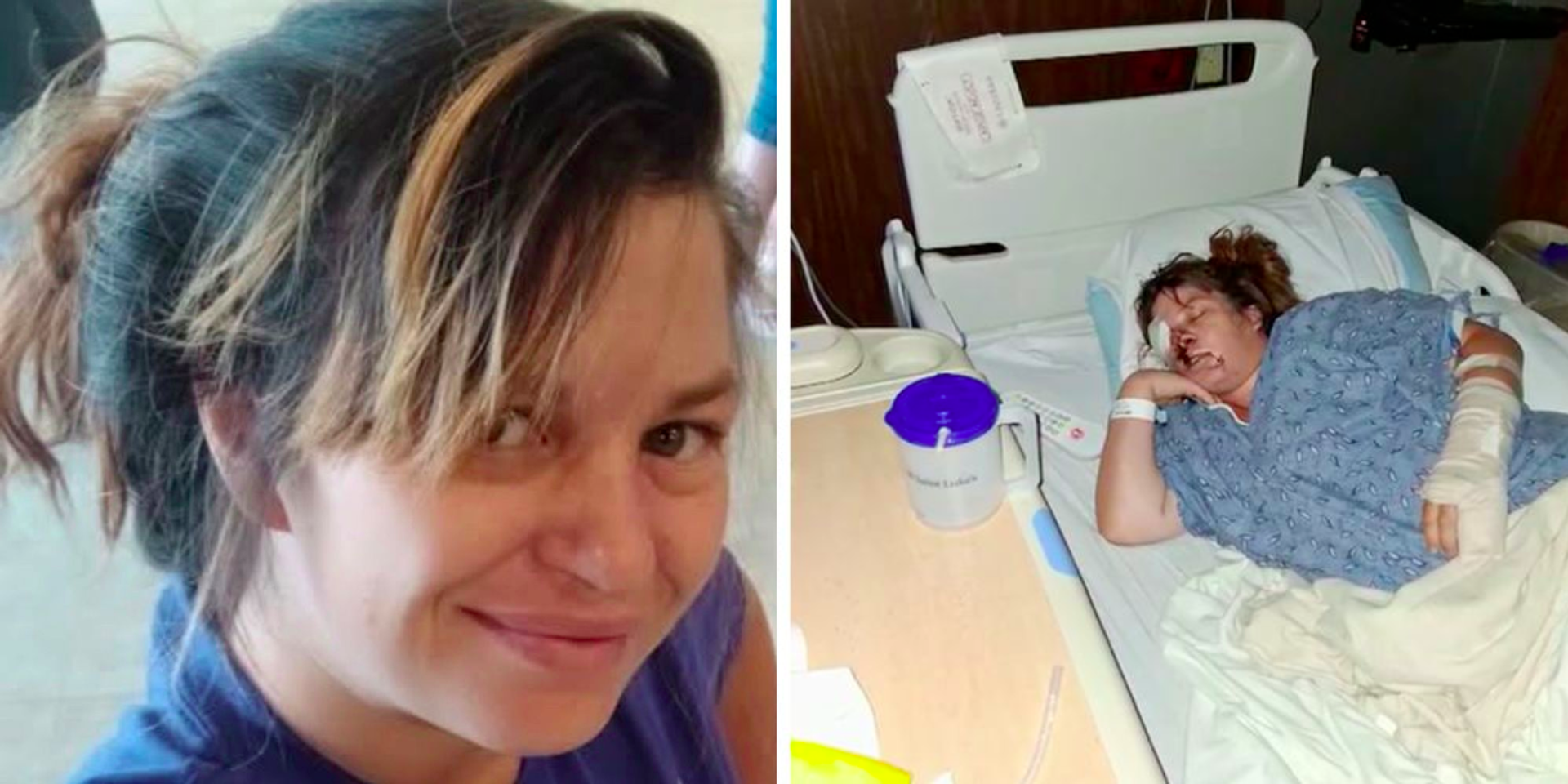 Family launches fundraiser after expectant mom of twins mauled by pit bulls in Texas—they attacked her face while she protected her stomach