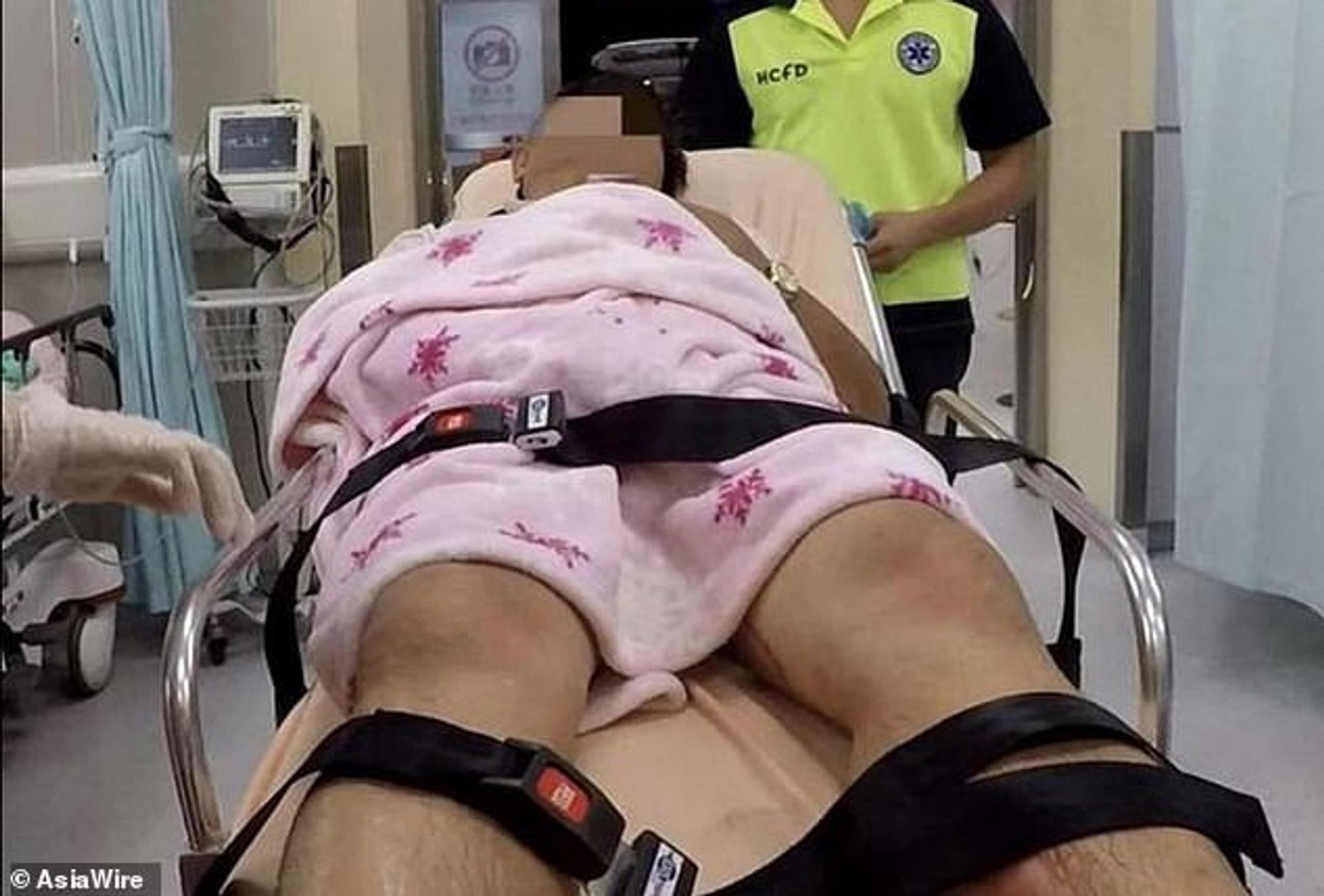 The man was rushed to hospital after his ex-wife cut off his genitals, doused them in acid and flushed them down the toilet