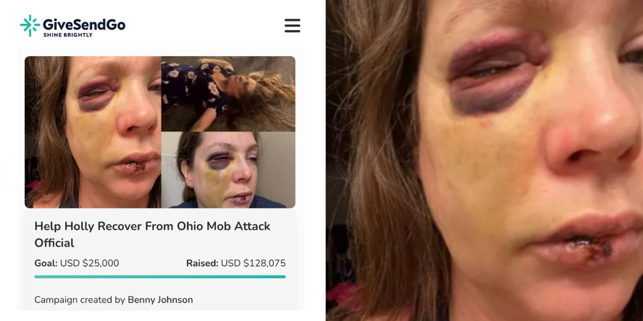 Benny Johnson's fundraiser for female victim of Cincinnati mob attack surpasses $100,000