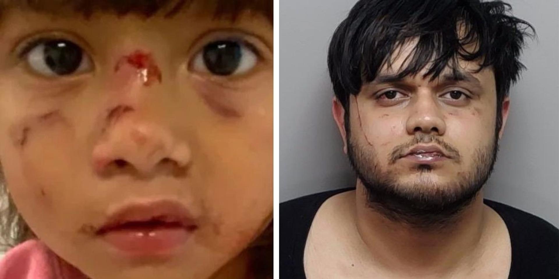 Illegal alien punches mother in unprovoked Texas park attack before snatching 3-year-old daughter, biting her arms, eating her face