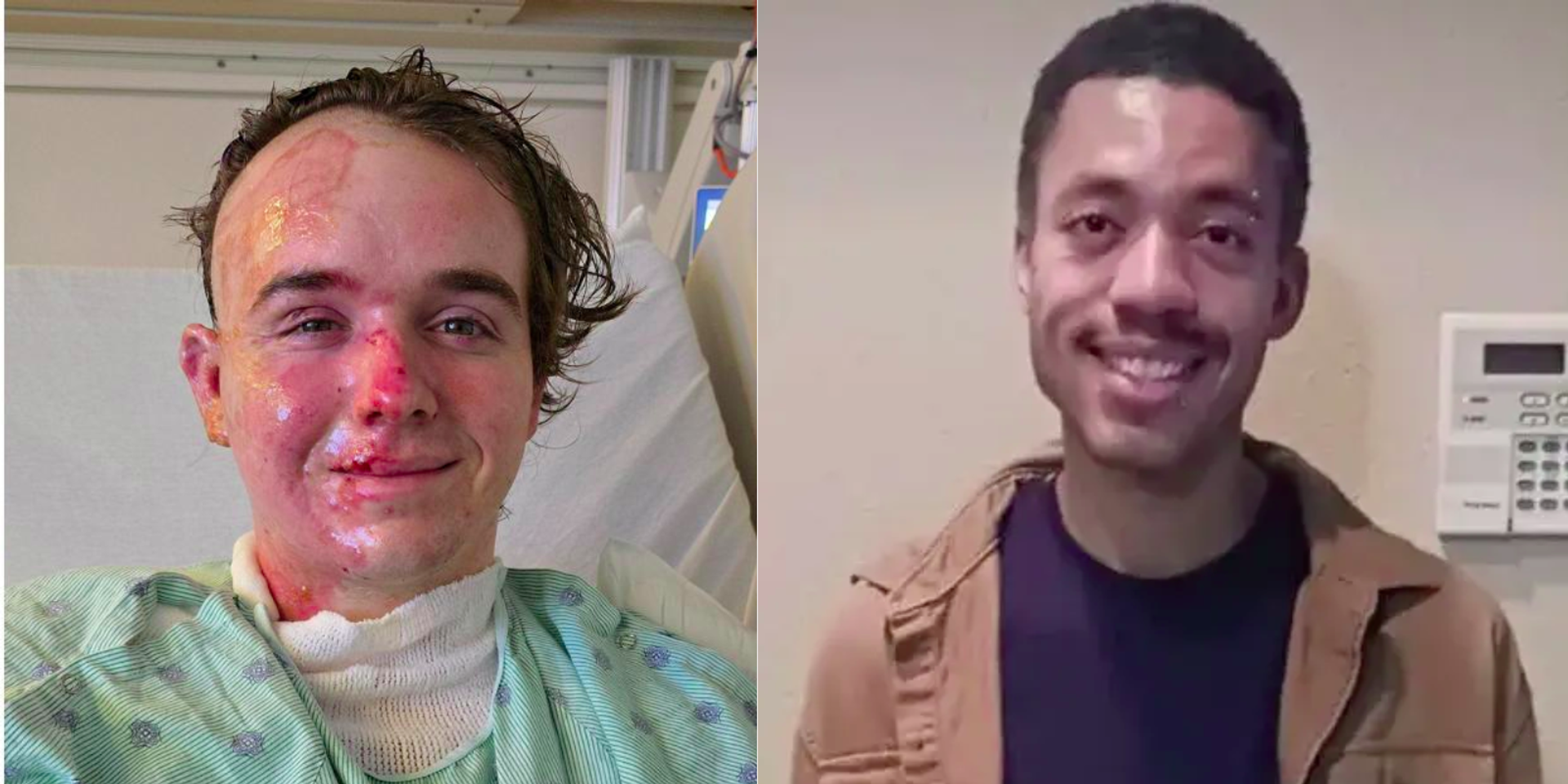 Black McDonald's employee arrested in California for throwing hot oil on white coworker, victim in ICU with burns to 22% of body