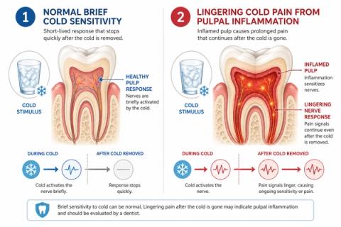 Comparison showing brief normal cold sensitivity that resolves quickly versus lingering cold pain caused by persistent inflammation inside the tooth.