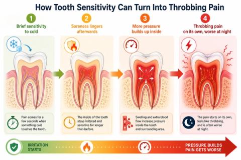 Timeline showing progression from mild sensitivity toward spontaneous throbbing tooth pain caused by advanced pulpal inflammation.