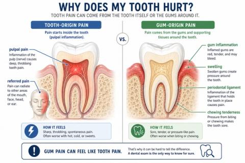 Comparative illustration of pulpal odontogenic pain versus periodontal pain, demonstrating how gingival inflammation, periodontal ligament inflammation, periodontal abscess formation, and supporting bone involvement can mimic dental pulp–related toothache, pressure sensitivity, and mastication pain.