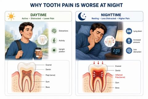 Comparison showing mild daytime tooth discomfort versus worsening night-time throbbing pain associated with pulpal inflammation, pressure changes, and increased pain awareness during rest.