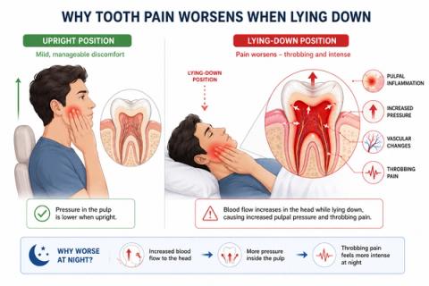 Comparison showing mild tooth discomfort while upright versus worsening throbbing pulpal pain caused by increased inflammatory pressure when lying down.