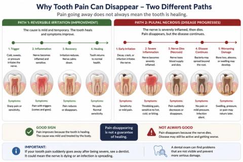 Comparison showing temporary symptom improvement versus loss of nerve vitality, highlighting why disappearing tooth pain does not always indicate healing.