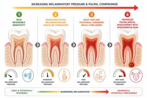 Timeline showing progression from mild tooth sensitivity toward inflammatory pulpal pain that worsens while lying down or at night.