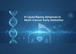 Liquid Biopsy Advances Revolutionize Multi-Cancer Early Detection