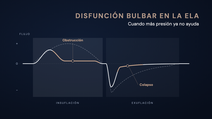 Curva de flujo esquemática de una insuflación-exsuflación mecánica: en la disfunción bulbar el flujo se aplana pronto durante la insuflación y se desploma tras el pico durante la exsuflación, en comparación con la curva normal discontinua.