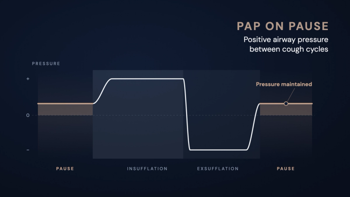 Schematic pressure curve of a BiWaze Cough cycle: pause with positive pressure maintained, insufflation with positive pressure, immediate switch to negative pressure during exsufflation, then another pause above zero.
