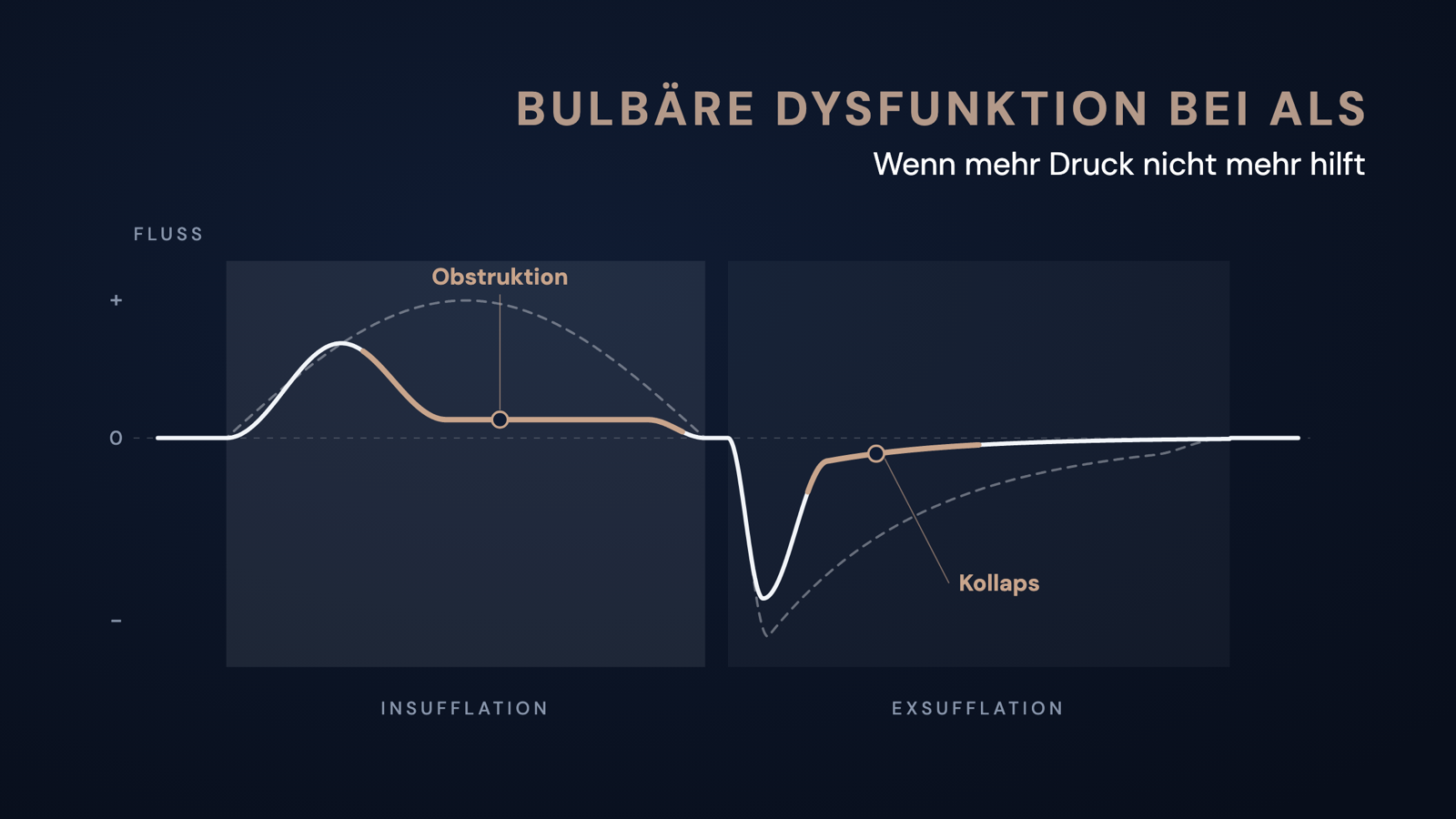 Schematische Flusskurve einer mechanischen Insufflation-Exsufflation: Bei bulbärer Dysfunktion flacht der Fluss in der Insufflation früh ab und bricht in der Exsufflation nach der Spitze ein, verglichen mit dem gestrichelten Normalverlauf.