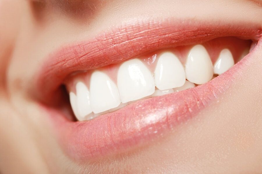 Close-up of woman's beautiful teeth and smile veneers in Campbell CA