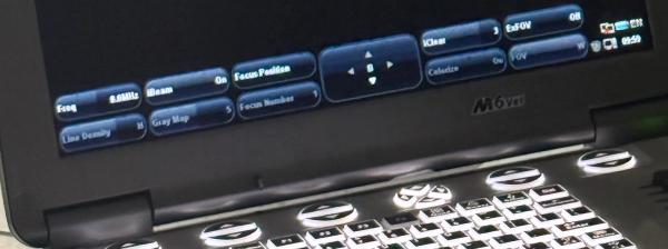 Bernedoodle puppies are on there way, pregnancy confirmed