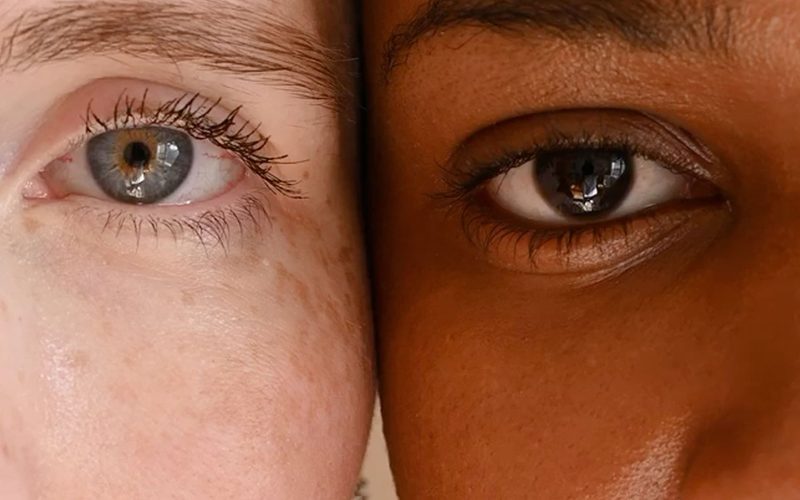 Eyes