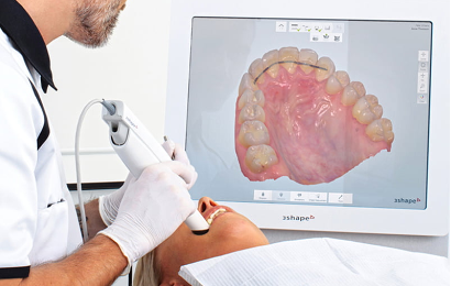 Intraoral Scanning