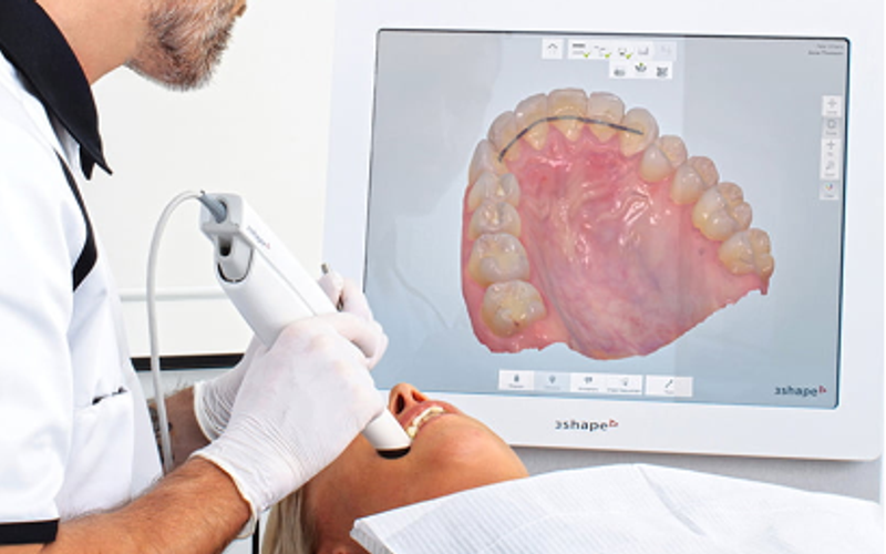 Intraoral Scanning