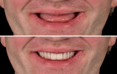 Same-Day Treatment