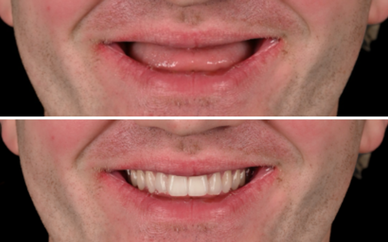 Same-Day Treatment