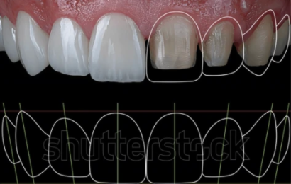 Digital Smile Design