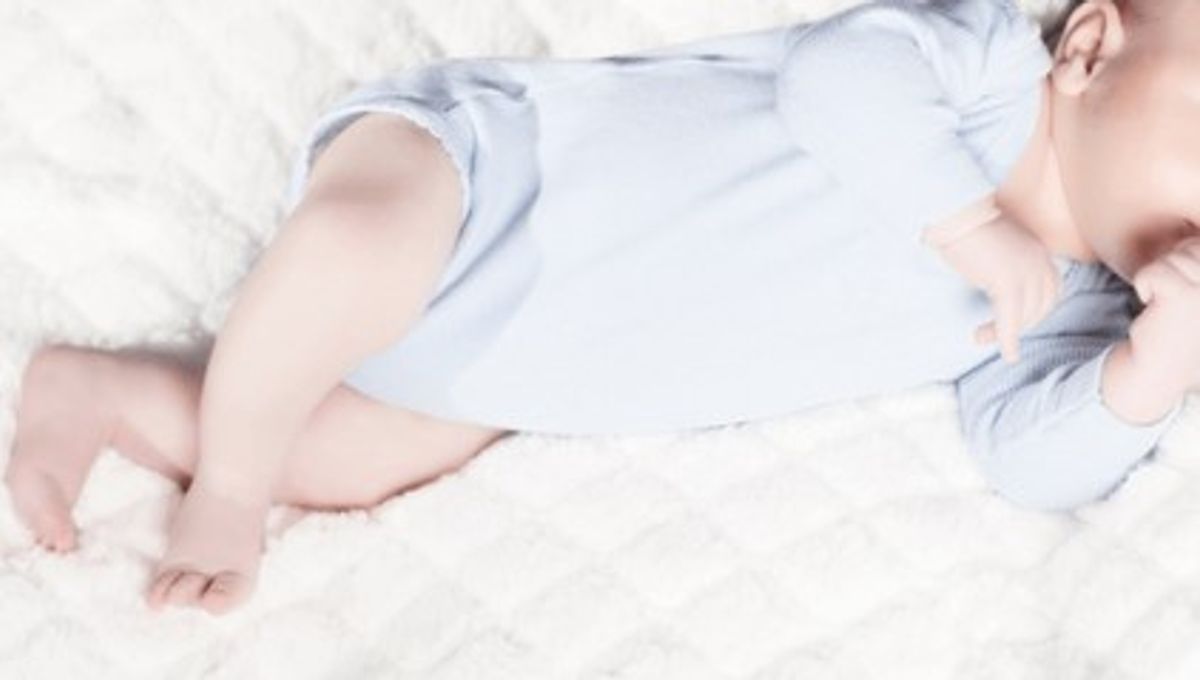 Acondroplasia (nanismo)