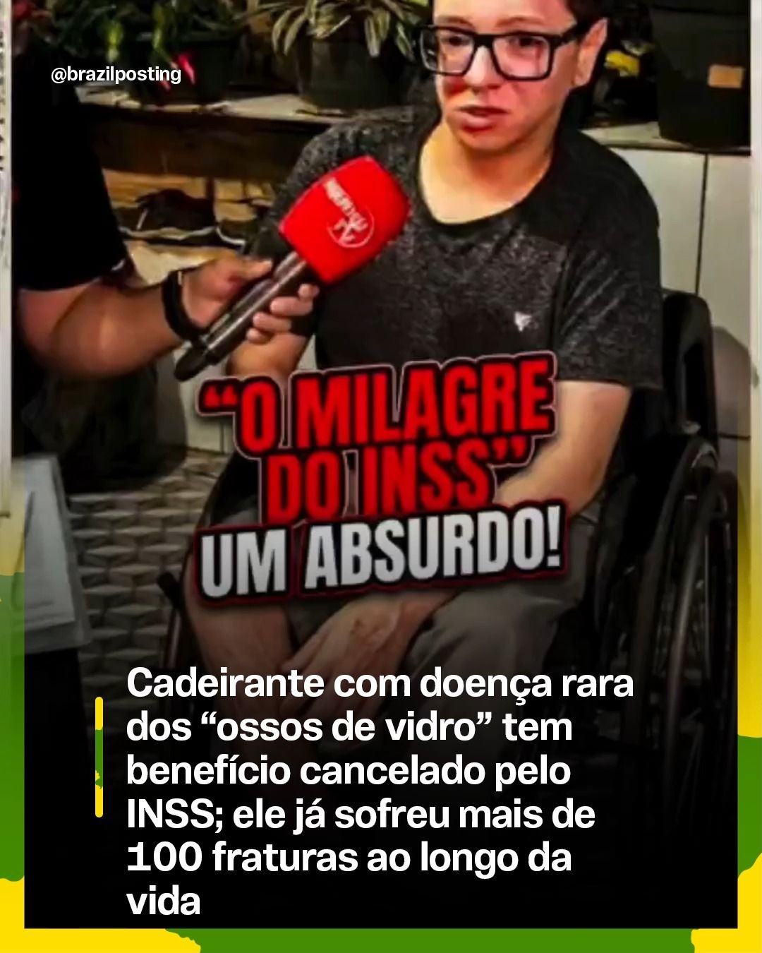 Homem com 'ossos de vidro' e mais de 100 fraturas tem benefício do INSS negado: deficiência foi classificada como leve