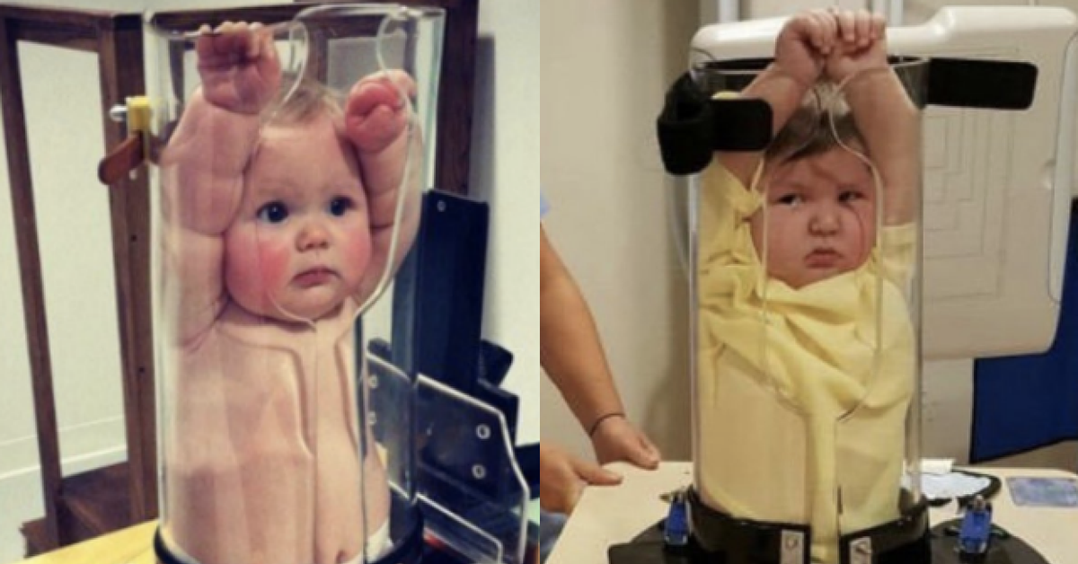 Baby X-rays Look Extremely Uncomfortable, So, Of Course, Twitter Made It Funny