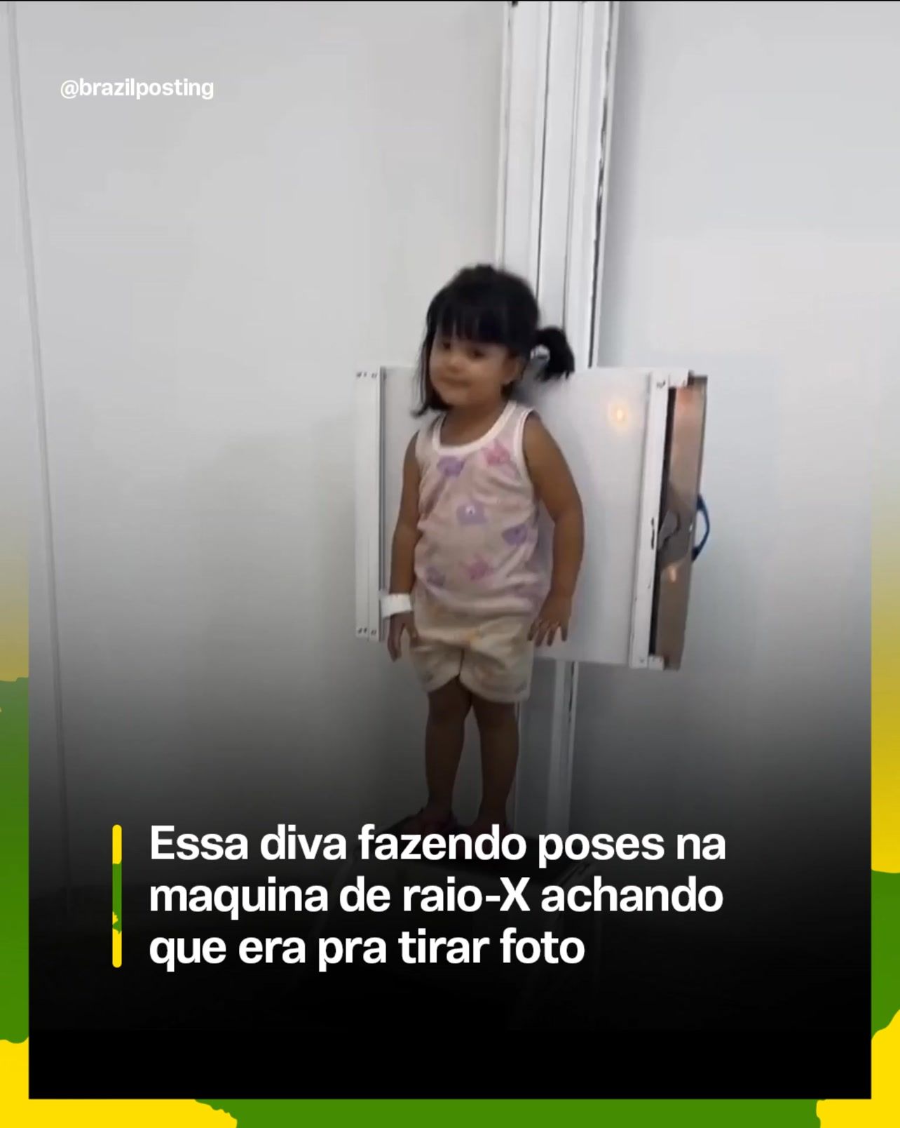 A criança que confunde a máquina de raio-X com cabine de foto: por que essa cena se repete em pronto-socorros do Brasil inteiro