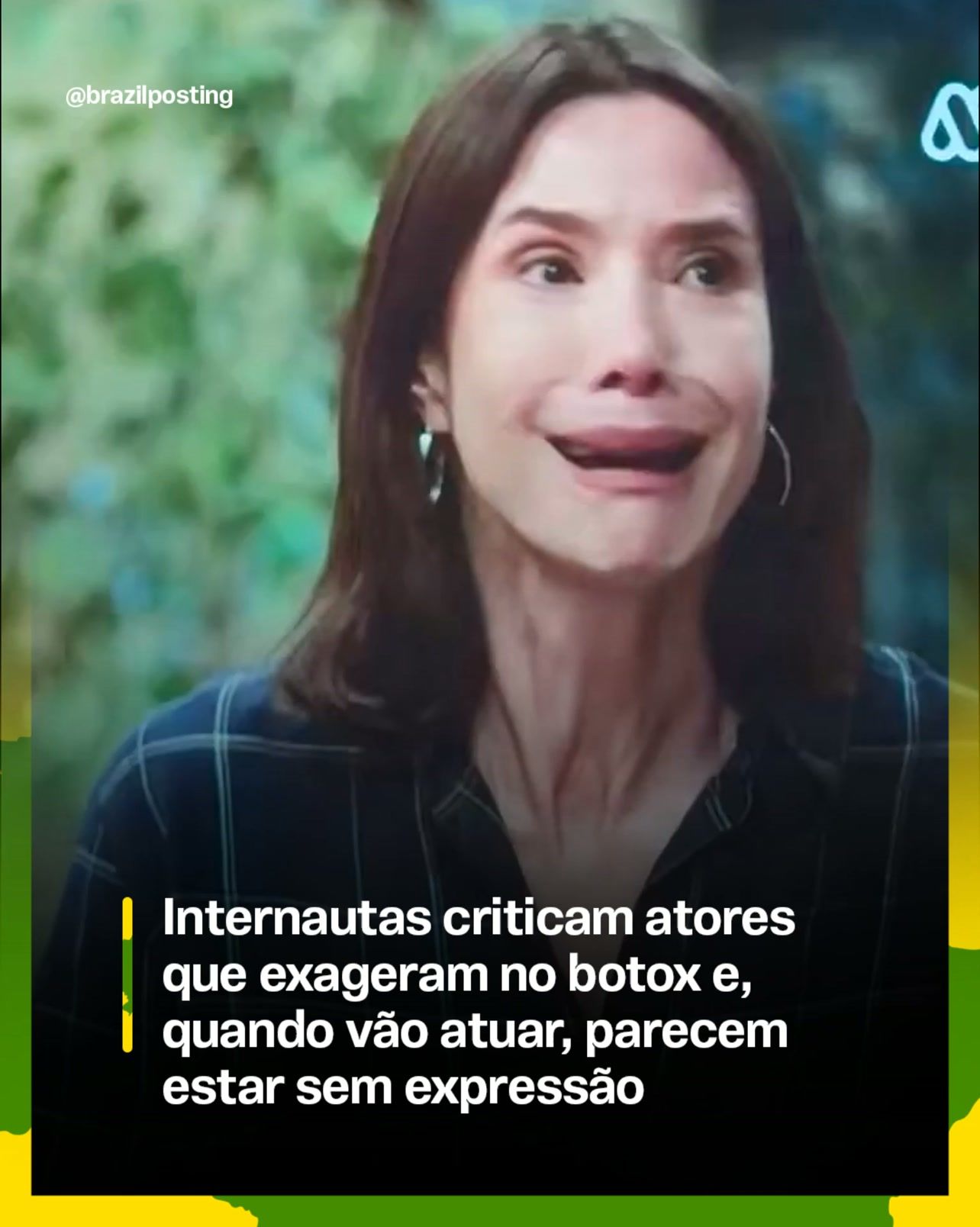 Botox em atores limita expressão facial, confirma ciência