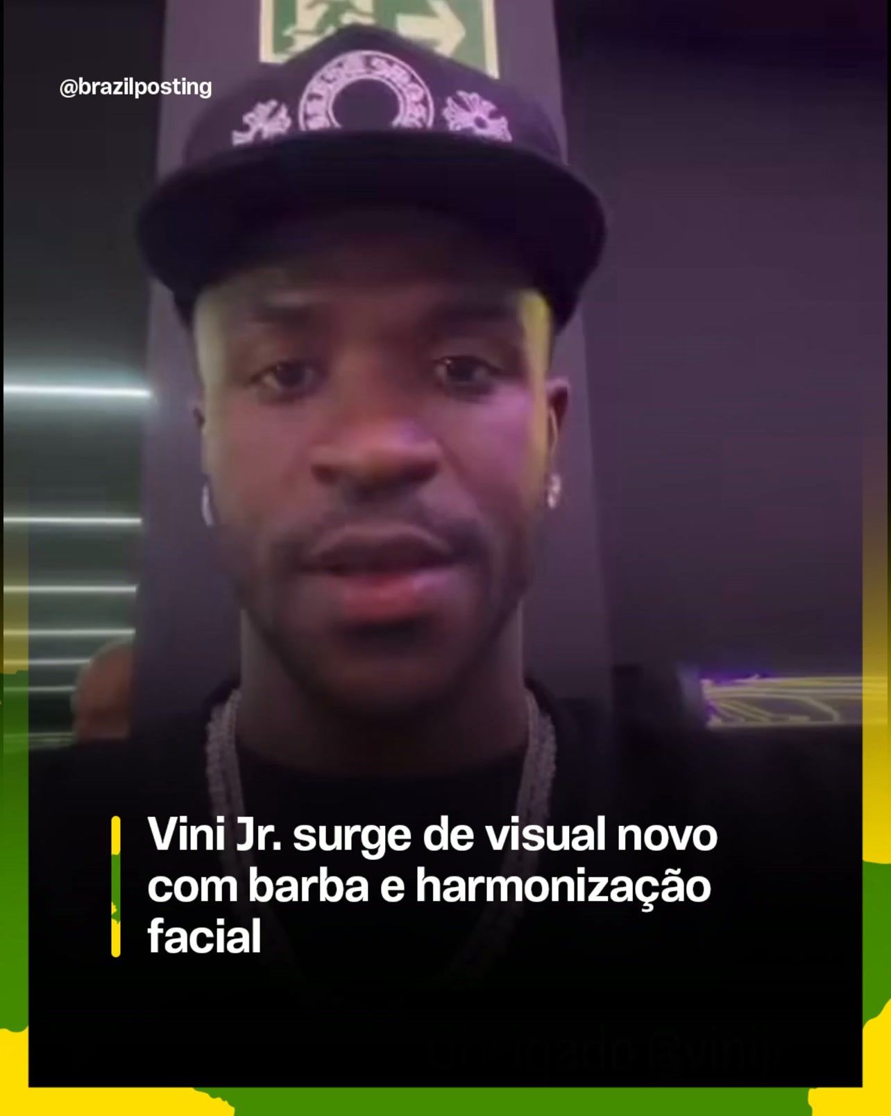 Vini Jr. surgiu com novo visual, barba e harmonização facial confirmadas