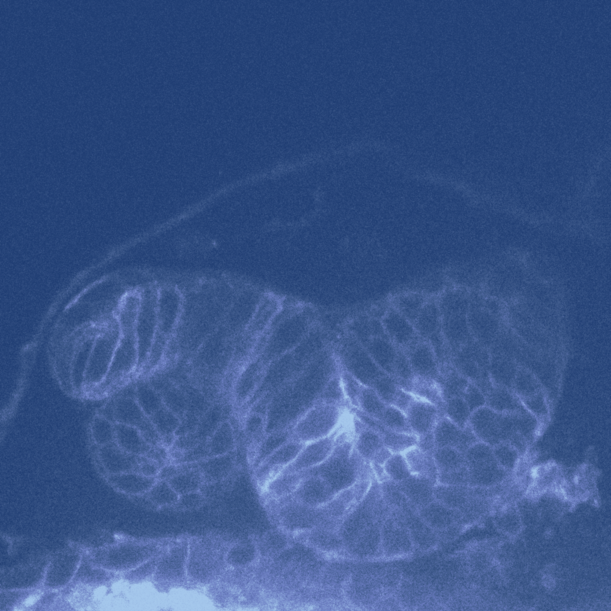 A pattern of folds that characterizes a juvenile sea urchin.