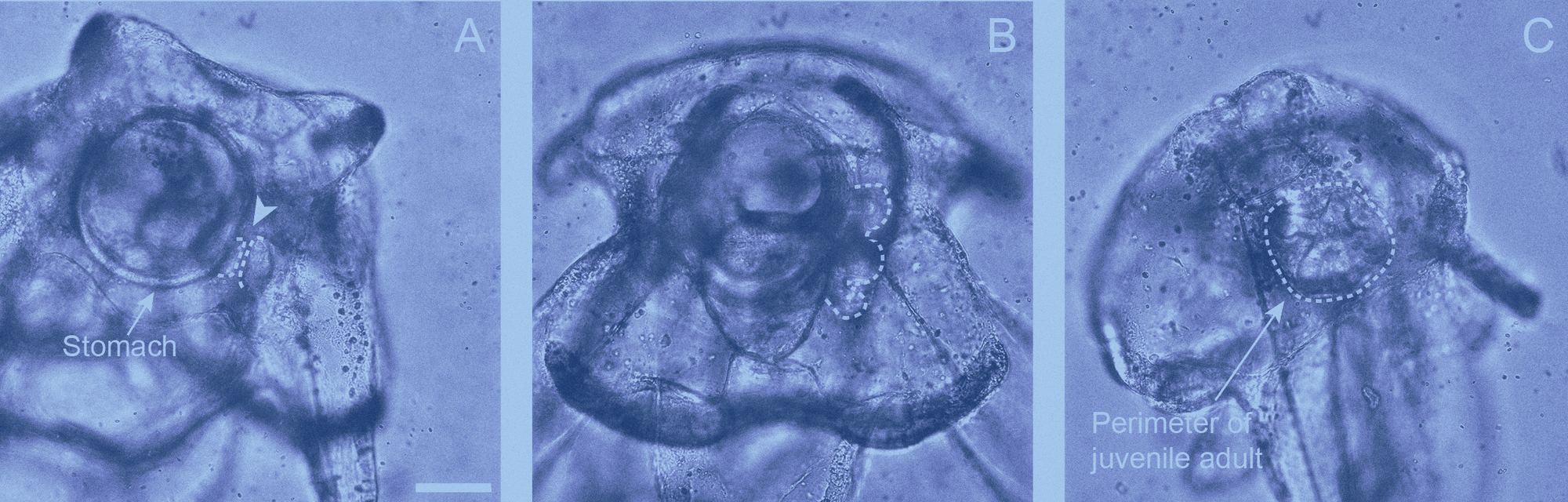 An image of a sea urchin under a microscope, with an arrow pointing towards and labeling its stomach and perimeter.