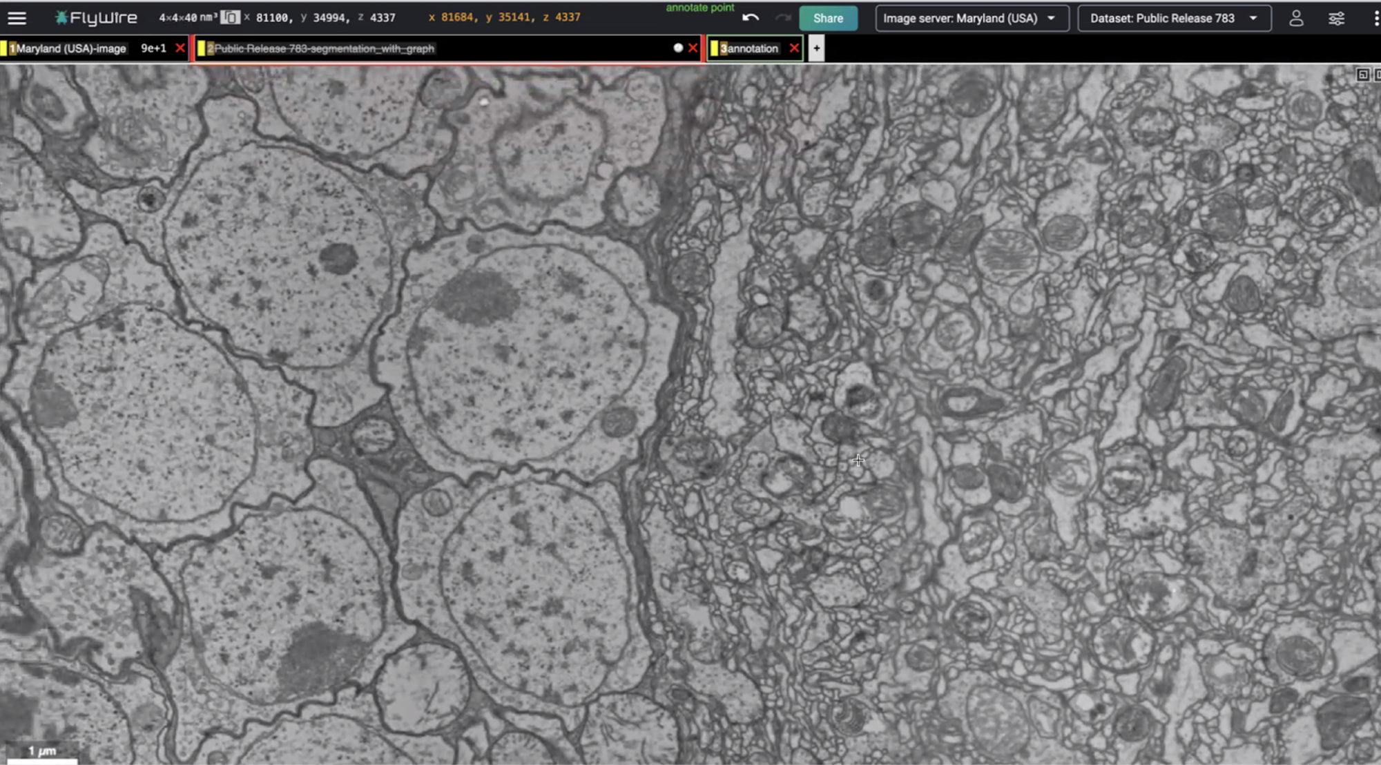 A screenshot of a zoomed-in section of a fruit fly brain, which looks more like an grey-scale amalgamation of rounded blobs.