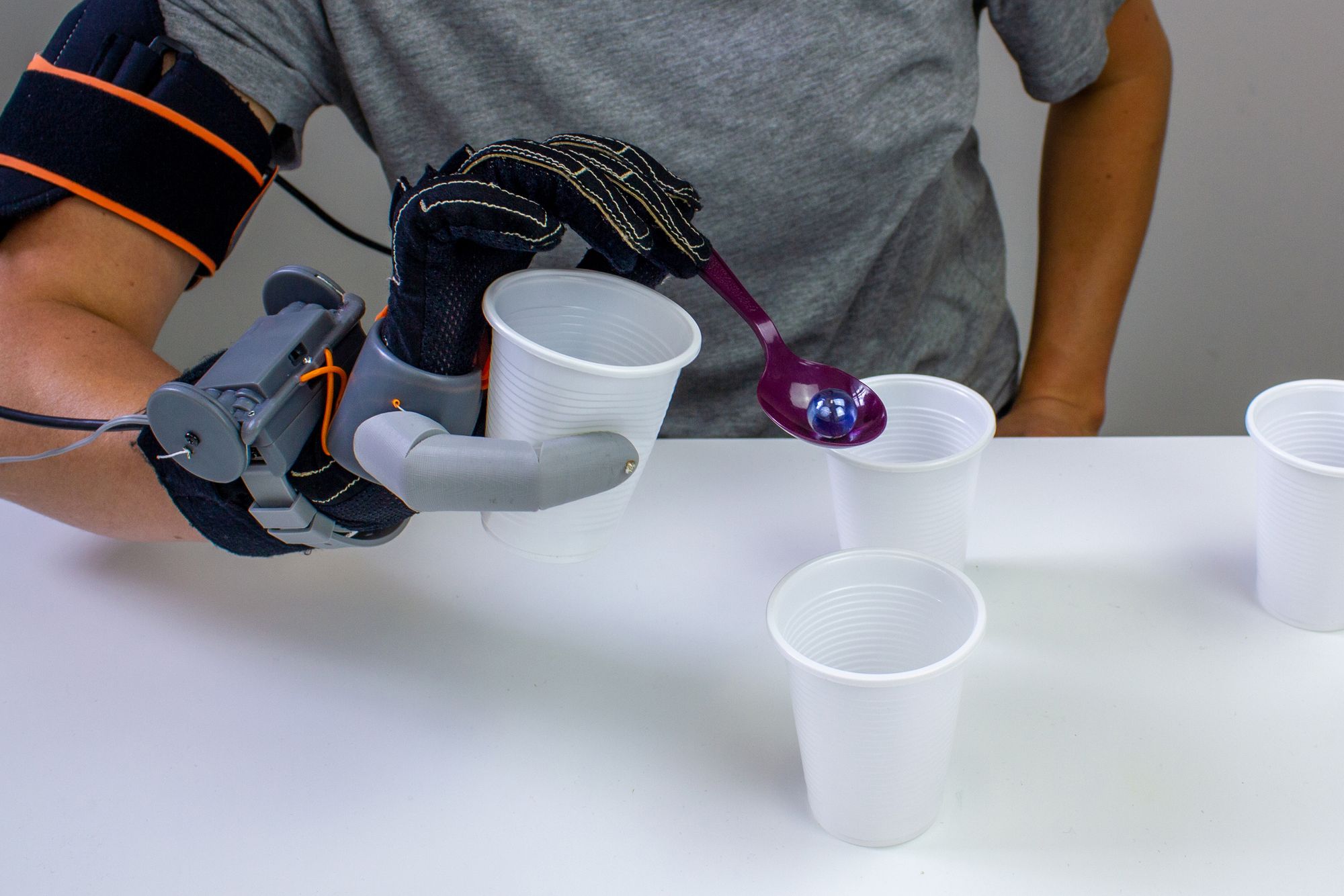 A person is demonstrating the third thumb glove invention by using one hand to hold a cup and a spoon at the same time. The hand is spooning a marble and there are several cups on the table.