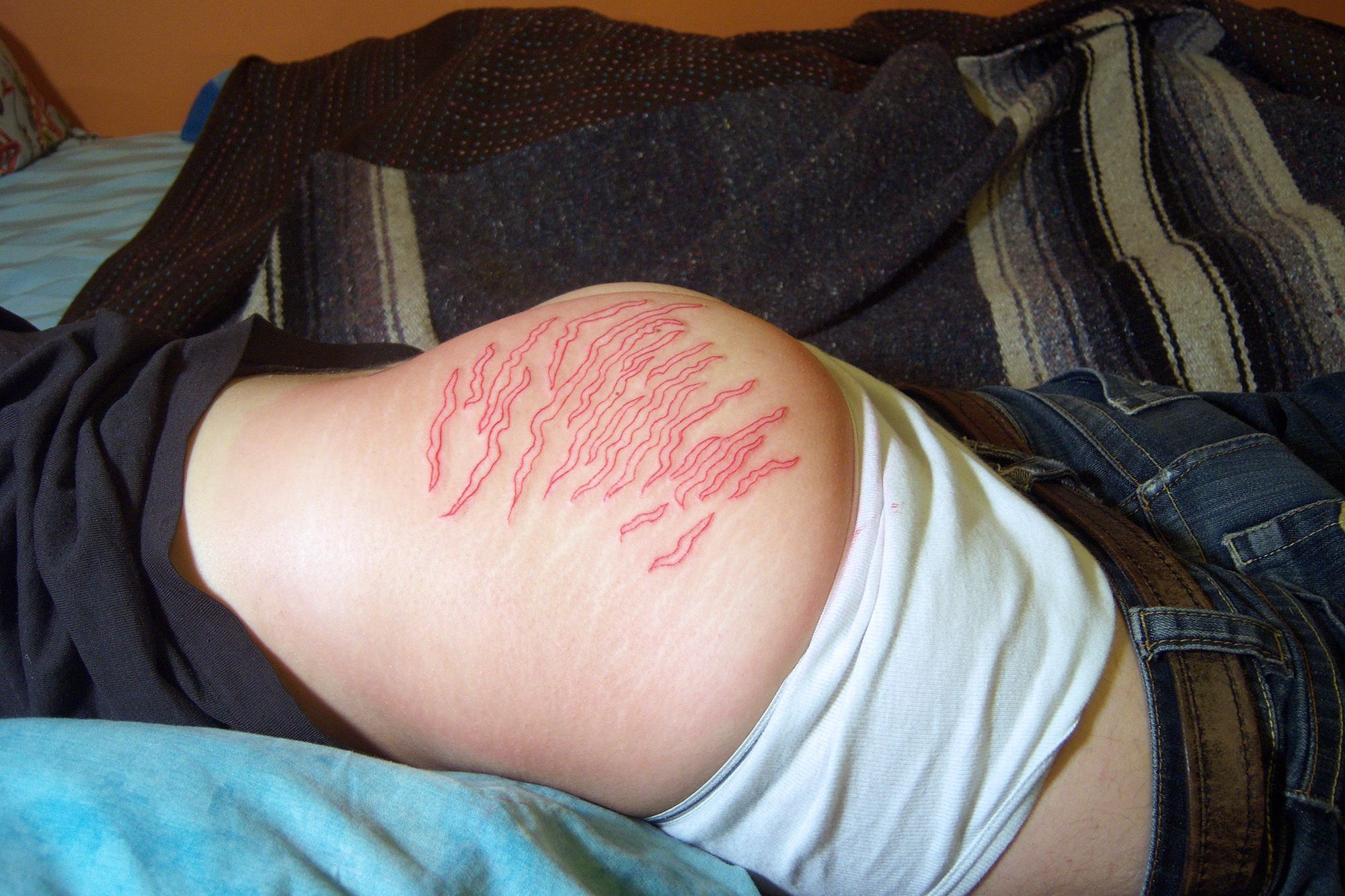 A photograph of someone lying face down in bed, their head obscured, with red tattooed stretch marks covering one side of their butt. 