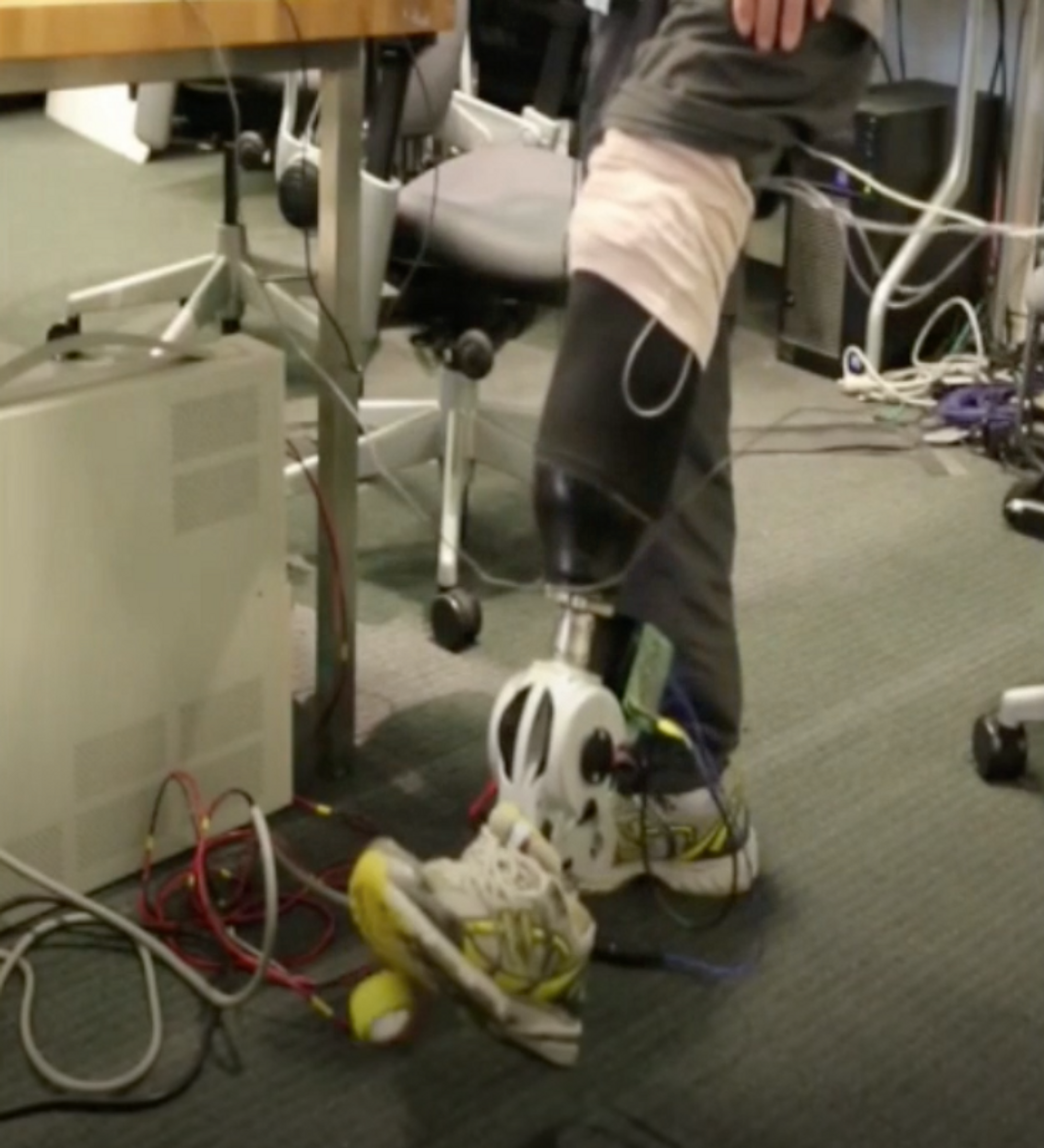Photo of Jim Lewis shaking tape from his bionic ankle.