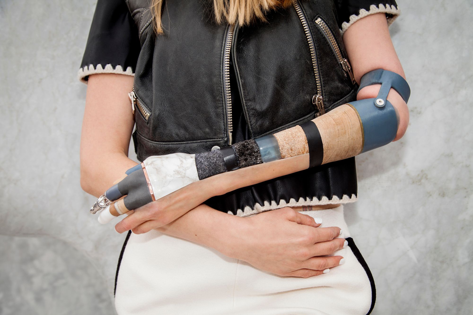 A close-up shows a prosthetic arm that is made up of many different materials and colors.