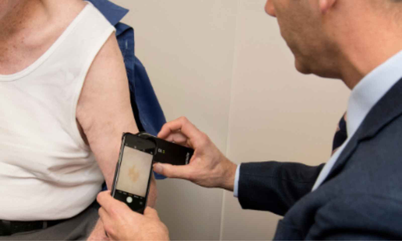 The skin cancer Pacific people rarely get but die from more often