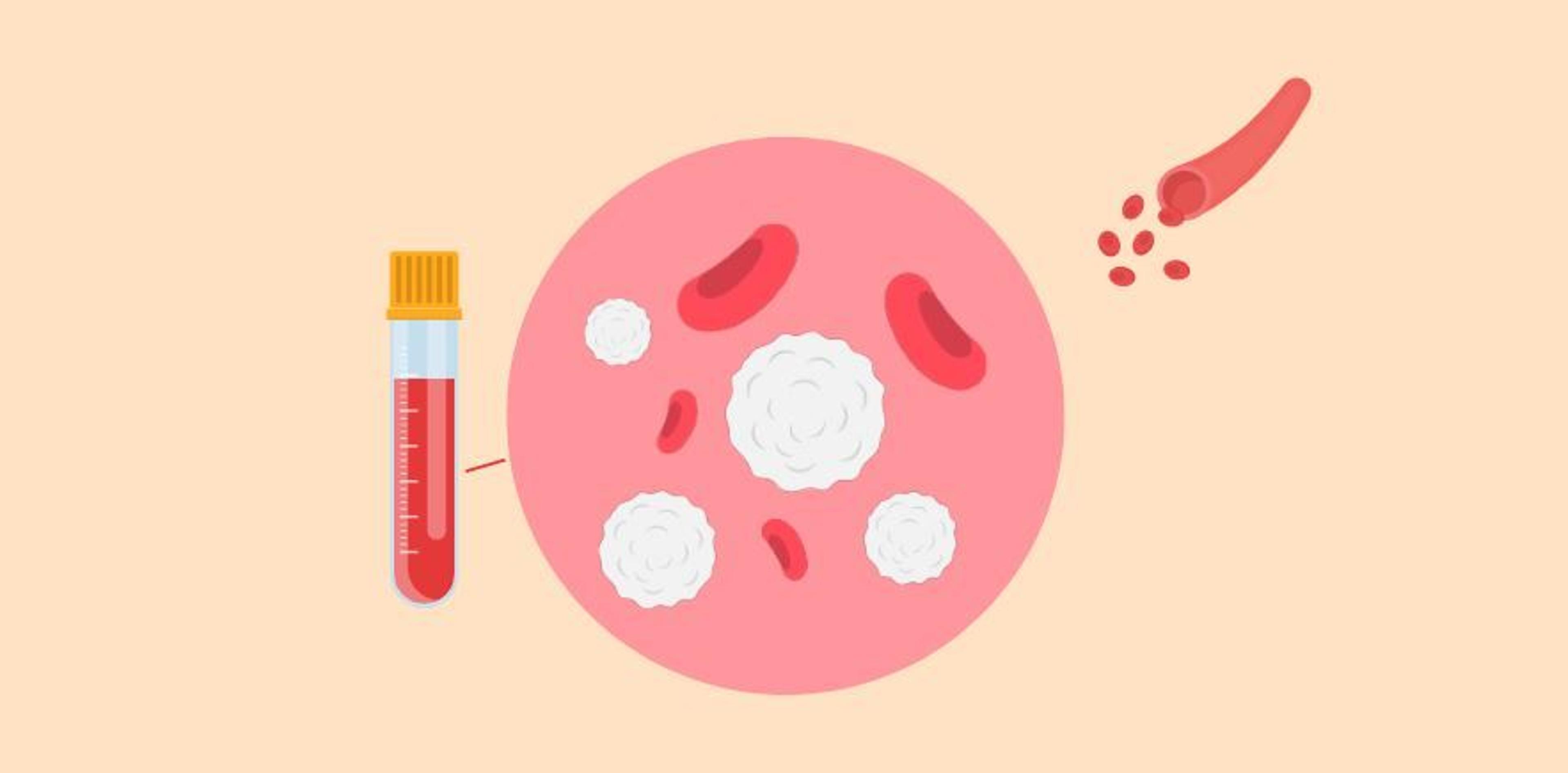 ​​Leukaemia and Blood Cancer New Zealand is calling on the government to give patients better access to up-to-date medication. Image/Policywise​​  ​Leukaemia and Blood Cancer New 