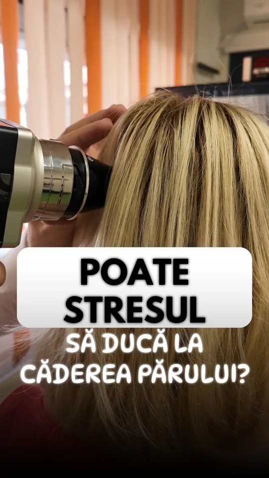 Conținut pentru Clinica Bioderm despre legătura dintre stres și căderea părului, cu Dr. Michael Russu.