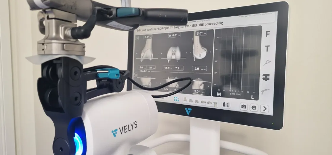 All'INI Grottaferrata, arriva VELYS: primo robot per la chirurgia protesica del ginocchio nei Castelli Romani