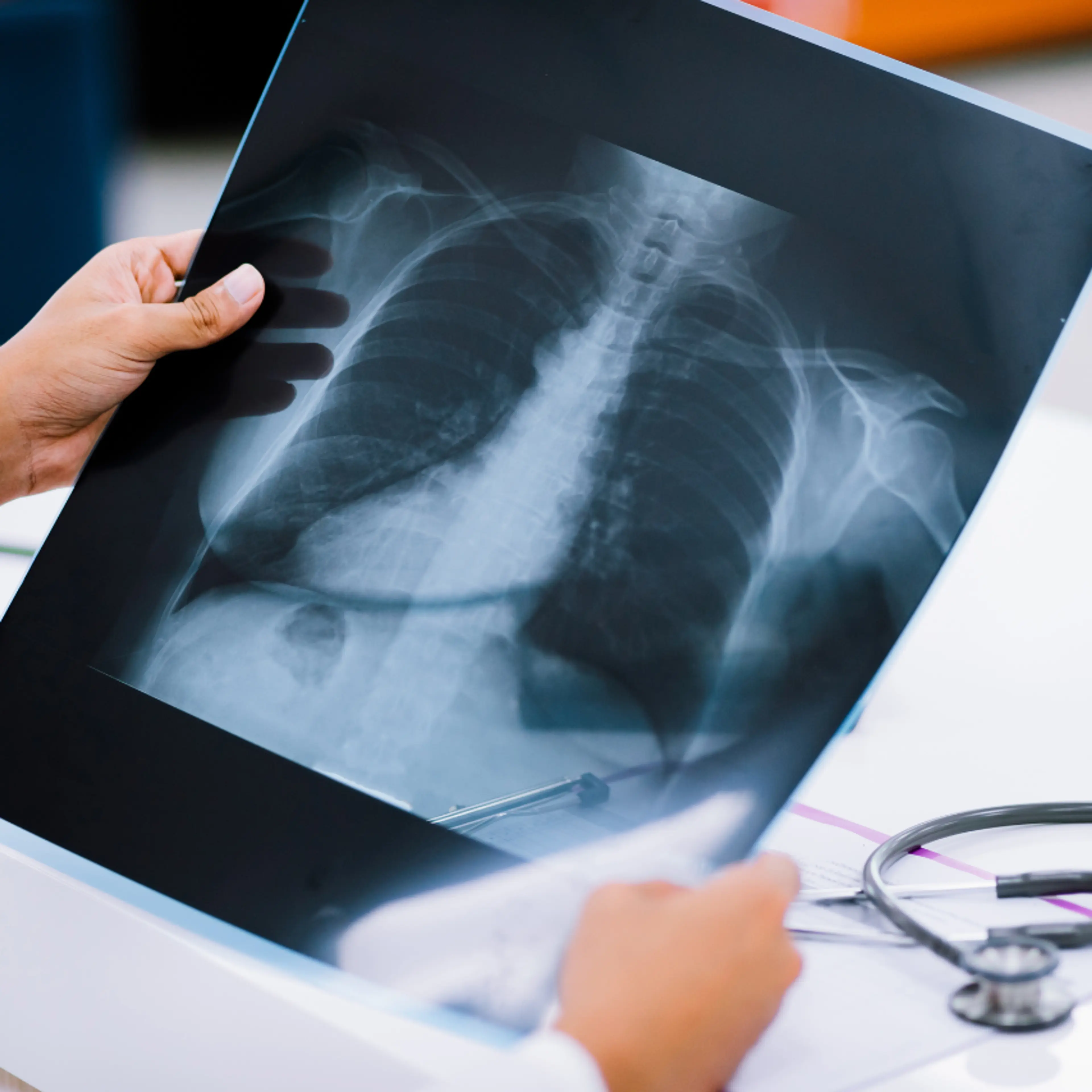 ¿Tienes más de 30 años? Estos los chequeos médicos que debes hacerte