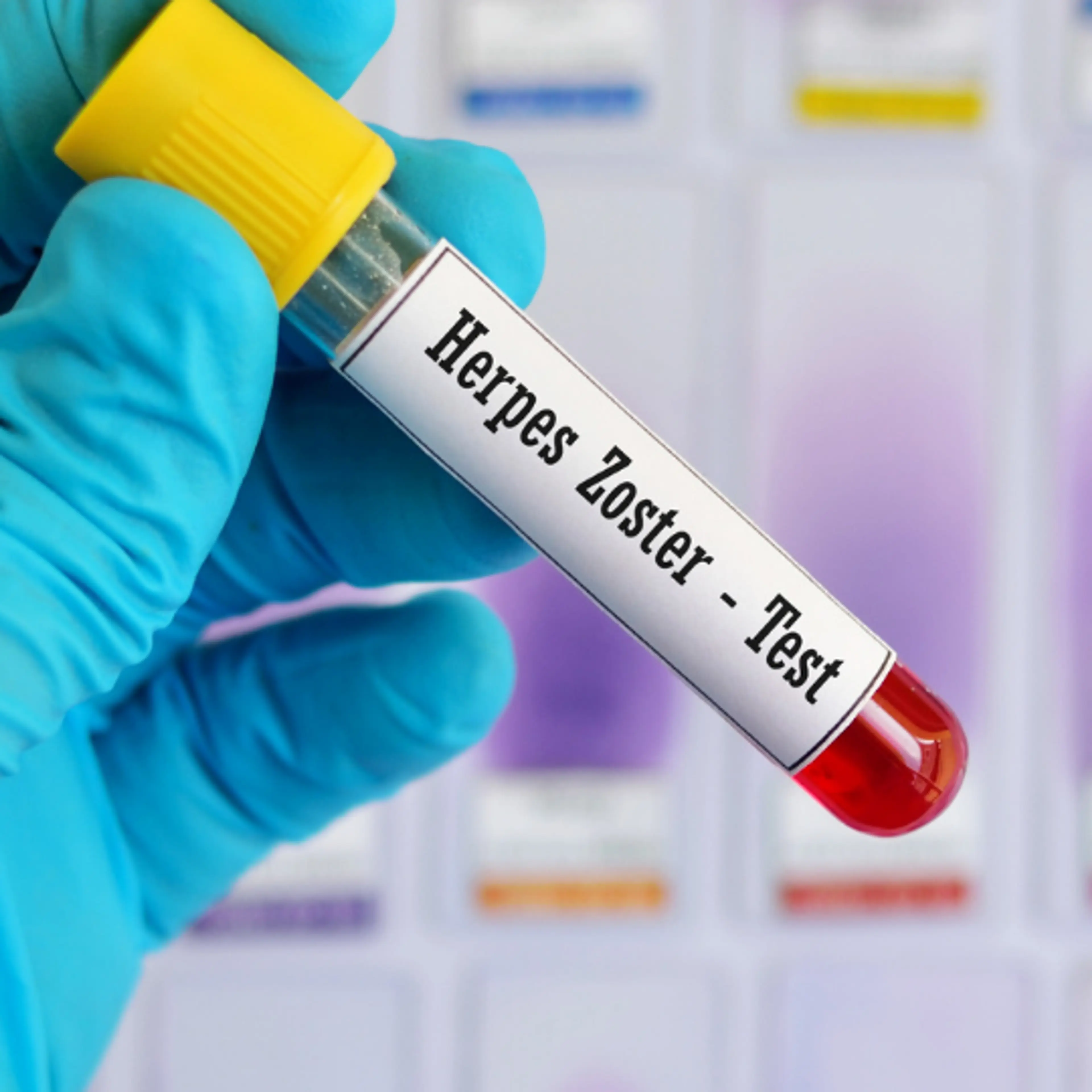 En Soy Más, el Dr. Francisco Moreno explica todo sobre el herpes zóster