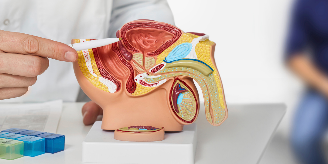 cáncer de próstata auna