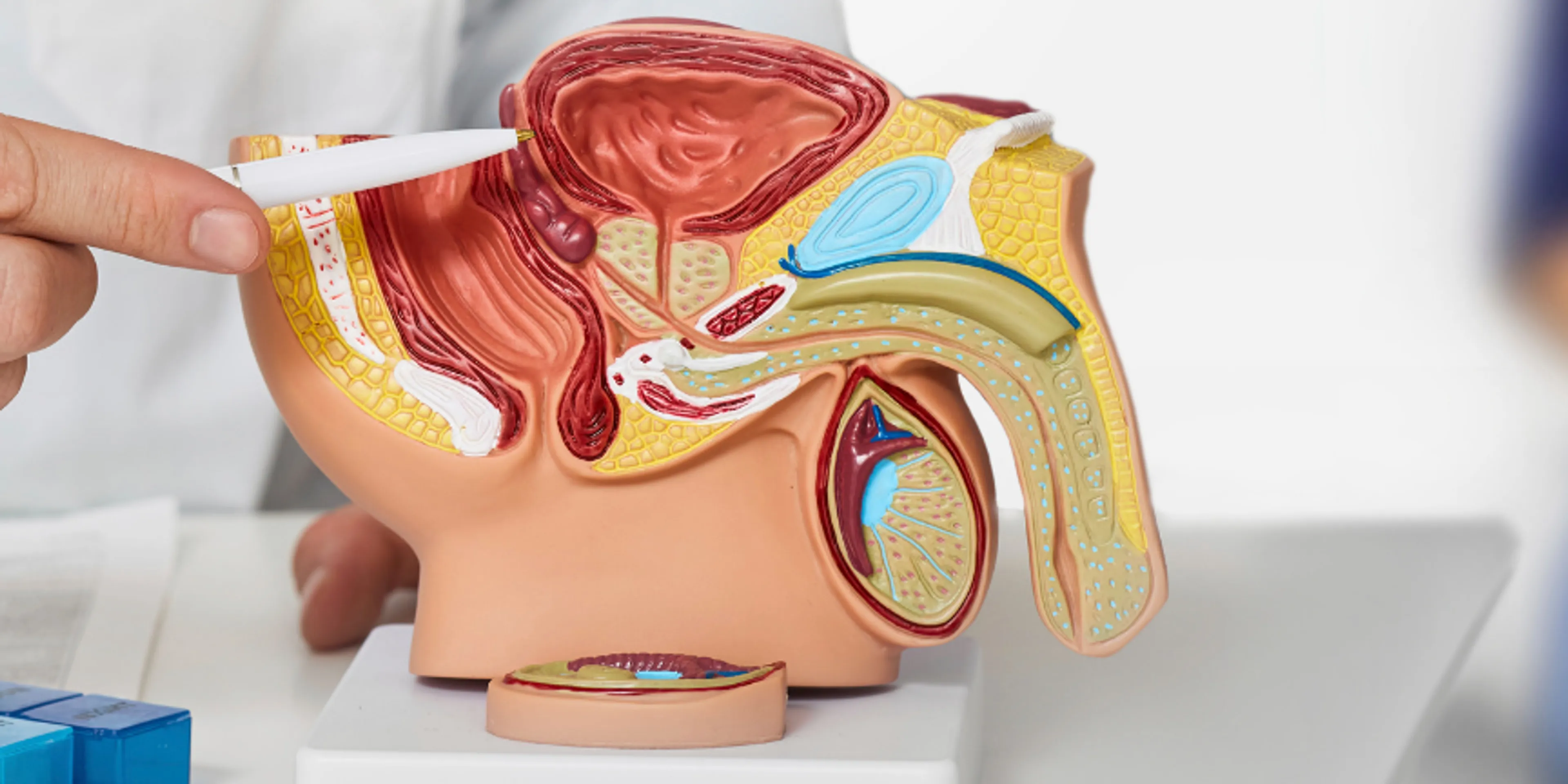 cáncer de próstata auna